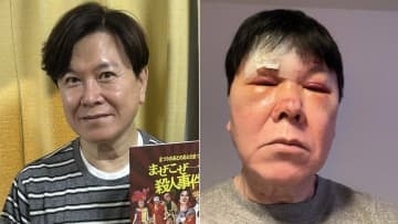 【 三ツ矢雄二 】酔って転倒・顔に大けが〝まぶたを4針・鼻を骨折〟脳内に出血も「『酒は飲んでも飲まれるな』ですね」と大反省