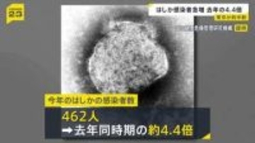 はしか感染者数462人　東京都が半分ほど占める