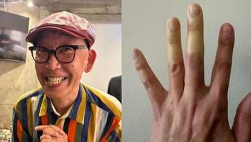 【 坂本ちゃん 】　指先の「激しい変色」で困惑　「きゃー！やだー！」「指先冷えてたいへーん！」　ファンからは「今すぐ病院行って」と心配の声