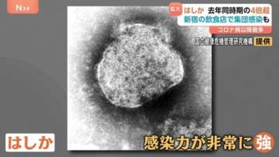 コロナ禍以降で最多…はしかが感染拡大　感染者が去年同時期の4倍超に　肺炎や中耳炎の恐れも【Nスタ】