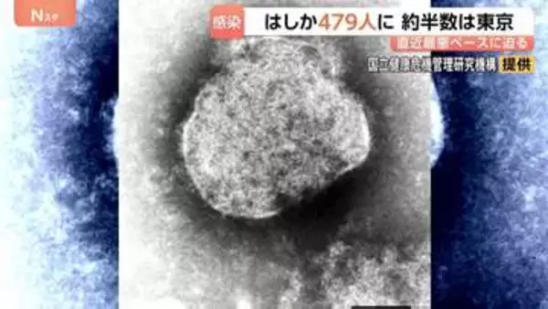今年のはしか感染者数479人 前年同期比4.1倍に　東京都が約半分の人数占める