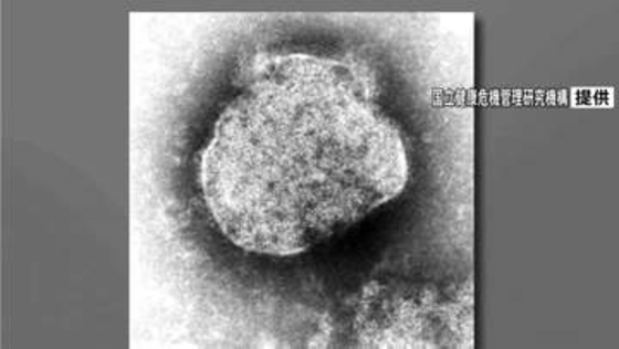 【速報】今年のはしか感染者数299人　去年1年間の数を上回る　国立健康危機管理研究機構