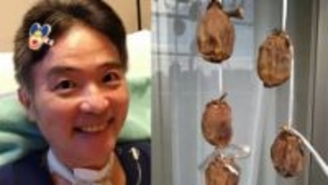 【ニャンちゅう】　声優・津久井教生さん　「いただいた干し柿が素敵に育って来ています」「仙豆の効果があると思っています♪」【ＡＬＳ闘病】