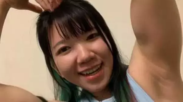 【 マッスルオペラちゃん 】 「『アーノルド・キアリ奇形』という脳の病気で手術を受けるため、しばらく休養いたします」