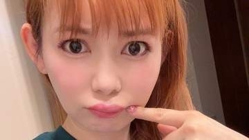 【中川翔子】「体調悪いとなるクインケ浮腫」「くちびるが腫れてしまった」痛々しい画像を投稿
