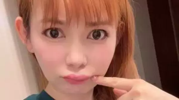 【中川翔子】「体調悪いとなるクインケ浮腫」「くちびるが腫れてしまった」痛々しい画像を投稿