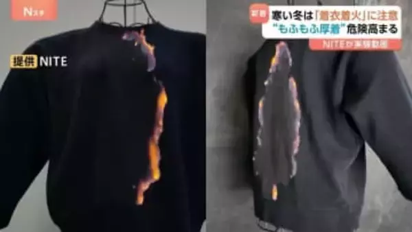 わずか5秒で“服が火に包まれる”…冬の「もふもふ火災」に注意　毎年約100人死亡の「着衣着火」 “表面フラッシュ現象”の恐ろしさとは