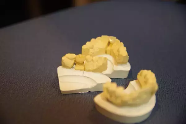 「宮藤官九郎が、今まで声をあげられなかった「歯科技工士」3名の愚痴を聞く！」の画像