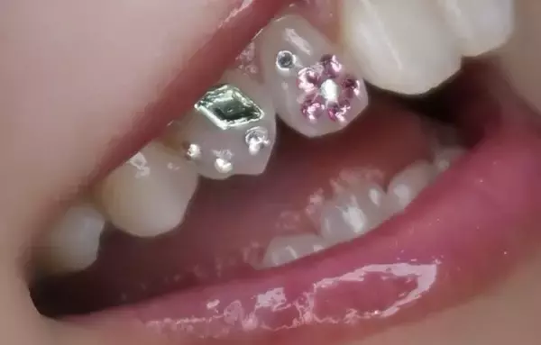 「笑顔が主役　話題のティースジュエリー」の画像