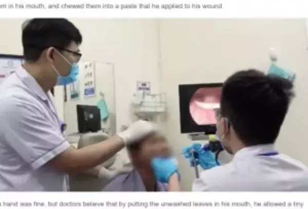 喉の奥から6センチのヒルを摘出した53歳男性、1か月前から違和感（ベトナム）＜動画あり＞