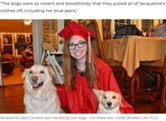 ペットシッターの大学生、2頭の犬に襲われ顔の一部を失う（米）
