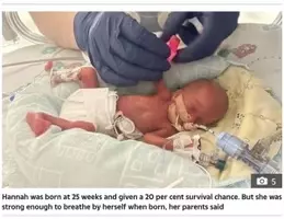 400グラム台で産まれた ミラクルベビー の双子 もうすぐ10か月に スコットランド 17年2月1日 エキサイトニュース 400グラム台で産まれた ミラクルベビー の双子 もうすぐ10か月に スコットランド 17年2月1日 エキサイトニュース