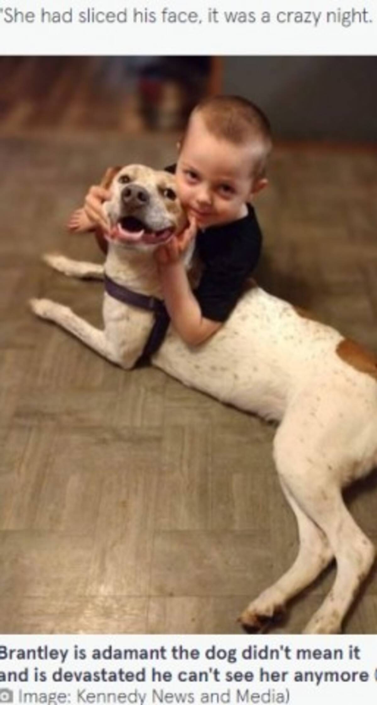 ベストフレンドの犬に顔を噛まれた5歳男児 息子は笑うことができなくなってしまった と母親 米 22年5月日 エキサイトニュース