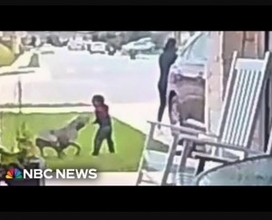 「噛みつく音が聞こえた」執拗なピットブルに襲われた2歳息子を母親が救う（米）＜動画あり＞