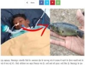池で泳いでいた14歳少年にとんだ災難　魚が口の中に飛び込み緊急手術へ（印）＜動画あり＞
