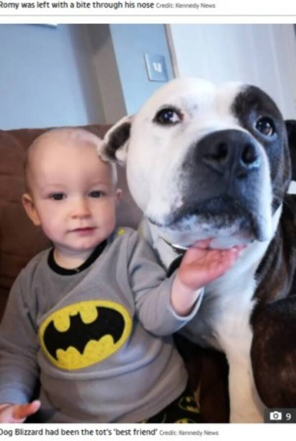 2歳男児 ベストフレンドの飼い犬に噛まれ鼻がちぎれ落ちる寸前に 英 22年4月24日 エキサイトニュース