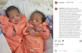 3回連続で双子を出産した女性　担当医師「とても信じられない」と仰天（米）