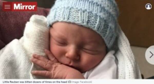 生後14日の赤ちゃん 飼い犬に頭部23か所を噛まれ死亡 おもちゃと勘違いか 英 22年1月12日 エキサイトニュース