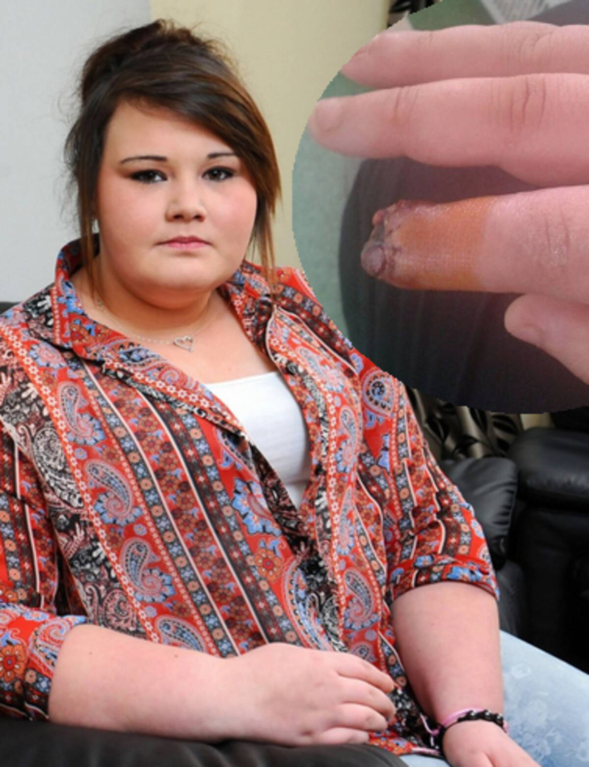 粗悪な つけ爪接着剤 で指先が壊死 深刻な感染症を発症した17歳少女 英 14年3月22日 エキサイトニュース