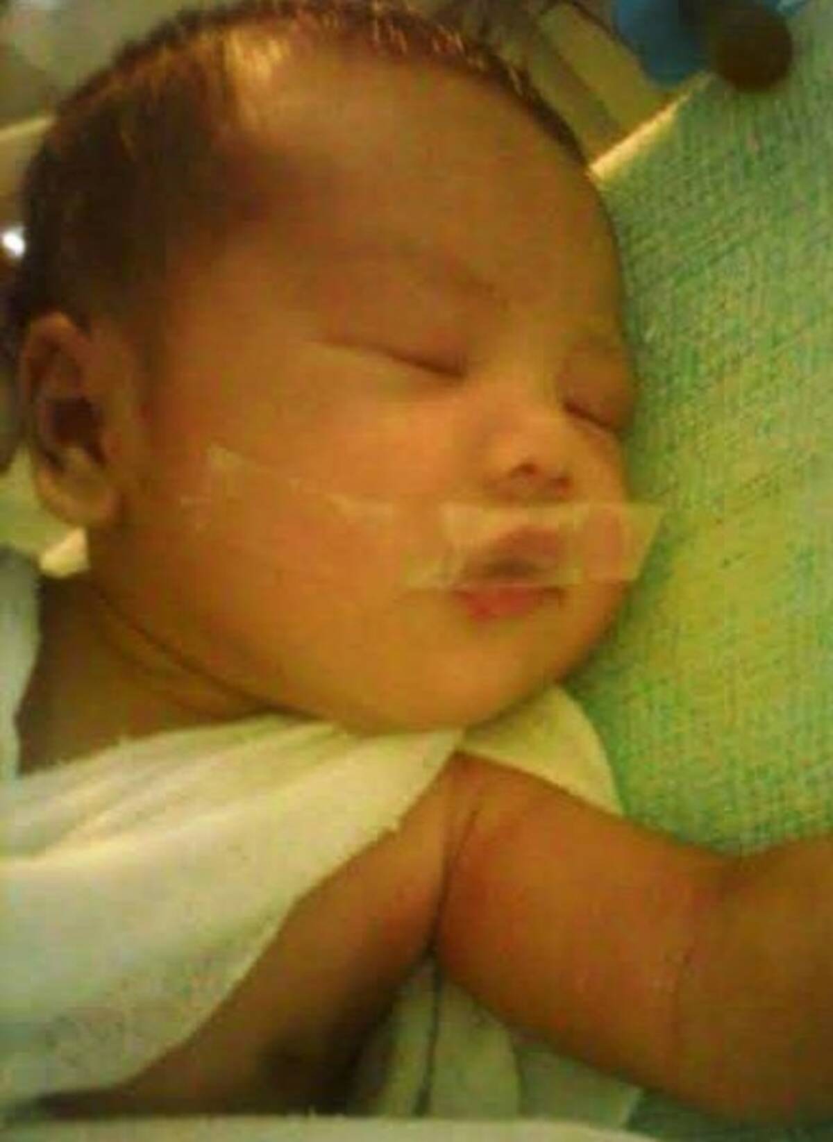 新生児の口をふさぐセロテープに両親ショック 看護師は よく泣いてウルサイから フィリピン 14年5月13日 エキサイトニュース
