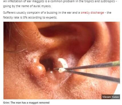 耳の穴にハエのうじ虫が 寝ている間に侵入 と耳鼻科医も警鐘 印 14年11月17日 エキサイトニュース