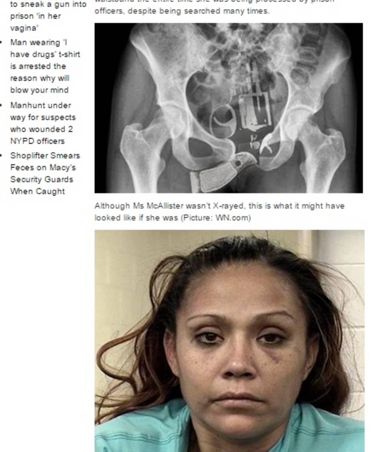 局部 に拳銃を隠し続けた女 レントゲン写真にショックの拘置所 米 15年1月11日 エキサイトニュース