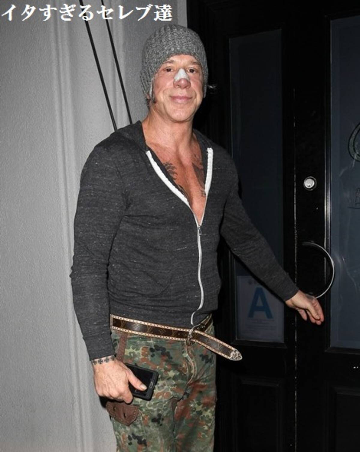 ミッキー ローク 60代にして整形止められず 体の骨まで利用し顔面へ 15年5月4日 エキサイトニュース