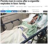 「電子タバコが顔の前で爆発。21歳男性が昏睡状態に（米）」の画像1