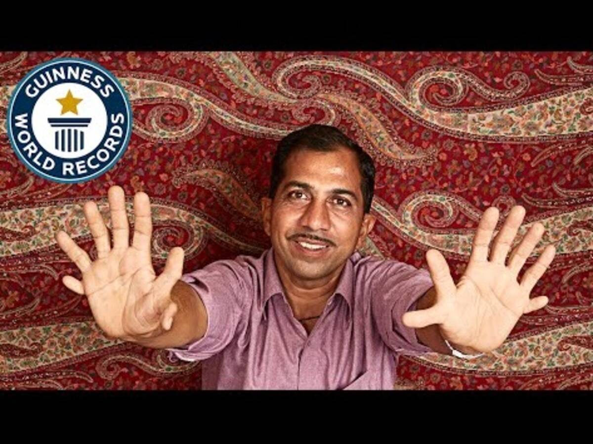 手足の指が計28本 インドの男性 ギネス世界記録 に 動画あり 16年2月1日 エキサイトニュース