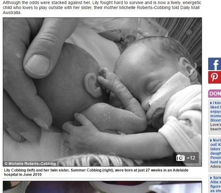 400グラム台で産まれた ミラクルベビー の双子 もうすぐ10か月に スコットランド 17年2月1日 エキサイトニュース