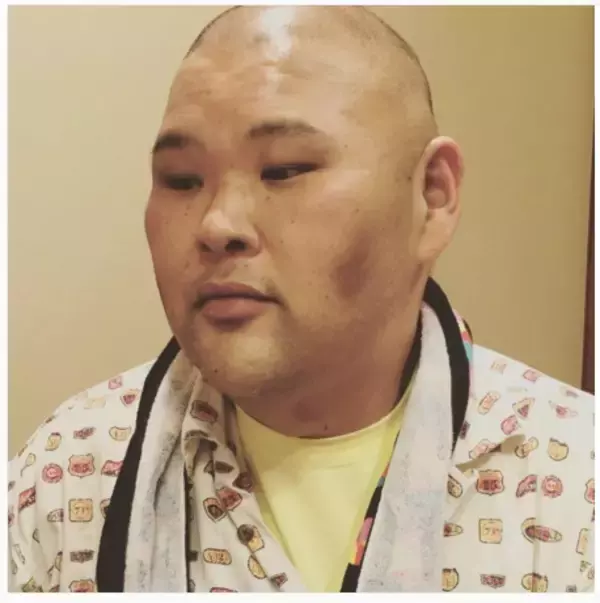 「安田大サーカス・HIRO　ダイエットで激痩せ　「無理はダメ」と心配の声」の画像