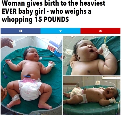 頭と胴だけの赤ちゃんがインドで誕生 医師 四肢がない以外は健康に見える 年6月30日 エキサイトニュース