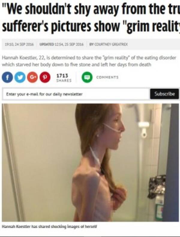 18歳で洋服は10歳サイズ 激ヤセした女性が拒食症の恐怖を語る 自らの写真を公開 英 16年9月29日 エキサイトニュース