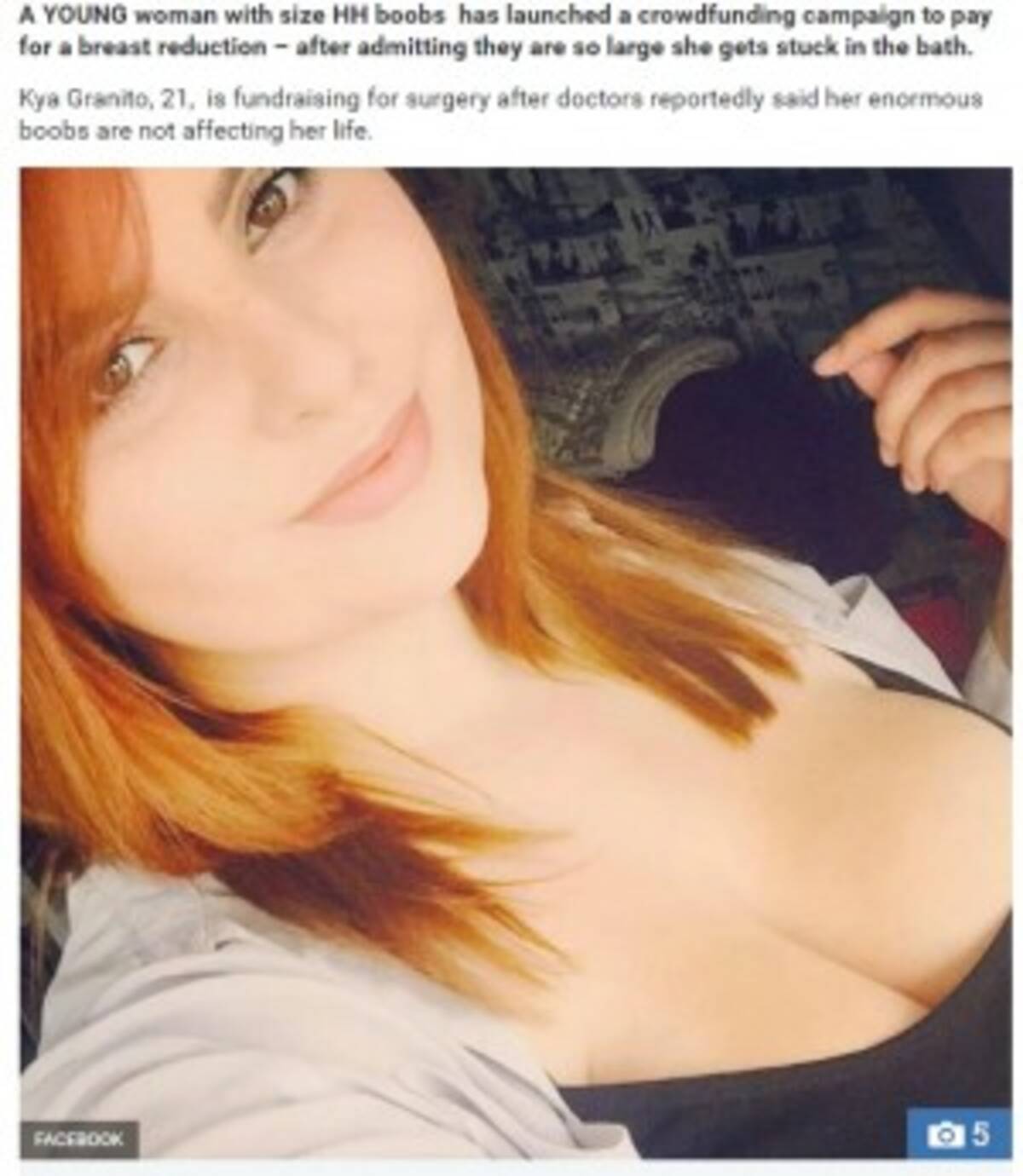 Hカップの美女 胸の縮小手術を受けたい ネット募金に訴える 英 16年11月日 エキサイトニュース Hカップの美女 胸の縮小手術を受けたい ネット募金に訴える 英 16年11月日 エキサイトニュース