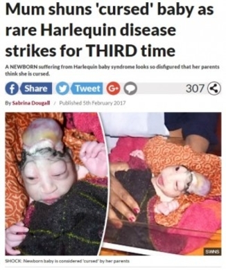 赤い肌を持つ 道化師様魚鱗癬 の4歳女児がモデルに 米 動画あり 年3月9日 エキサイトニュース