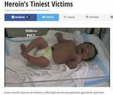 「ヘロイン中毒の母親から誕生した赤ちゃん　激しいケイレン止まらず（米）」の画像1