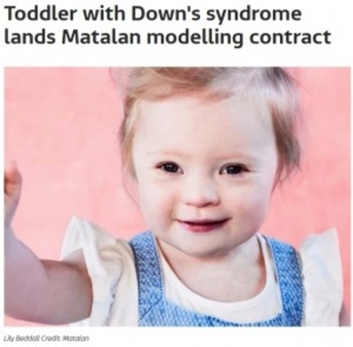 はじける笑顔が止まらない ダウン症の2歳児がキッズブランドのモデルに 英 年8月28日 エキサイトニュース