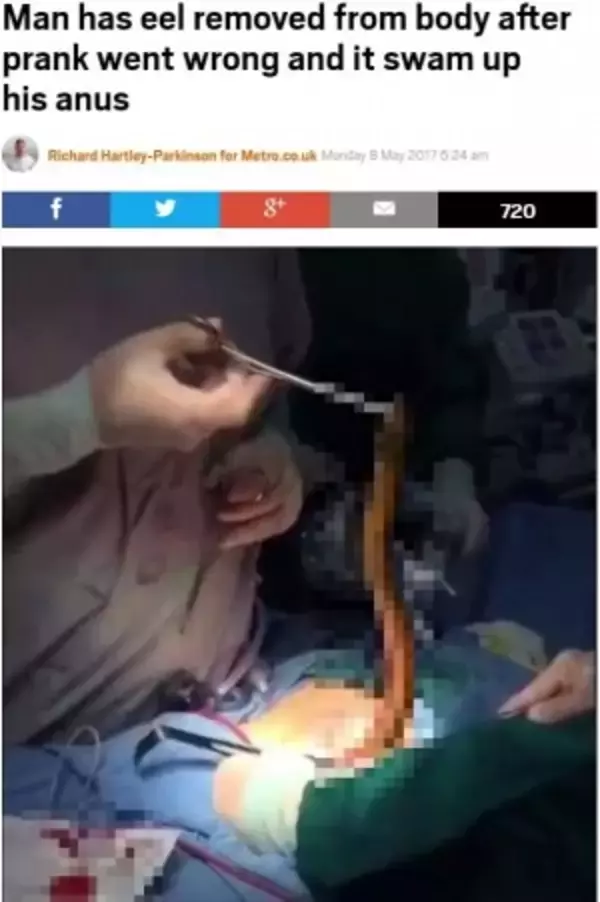 肛門に生きたウナギを入れた中国の男性、激痛で胃から摘出手術＜閲覧注意＞