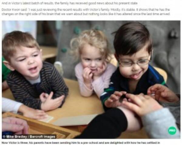 左右のバランスが崩れる頭部 世界にたった0名の Cloves症候群 と闘う3歳児 米 17年6月10日 エキサイトニュース