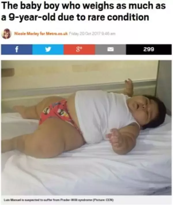 「生後10か月の男の子　過度の体重増加が止まらず30kgに（メキシコ）」の画像