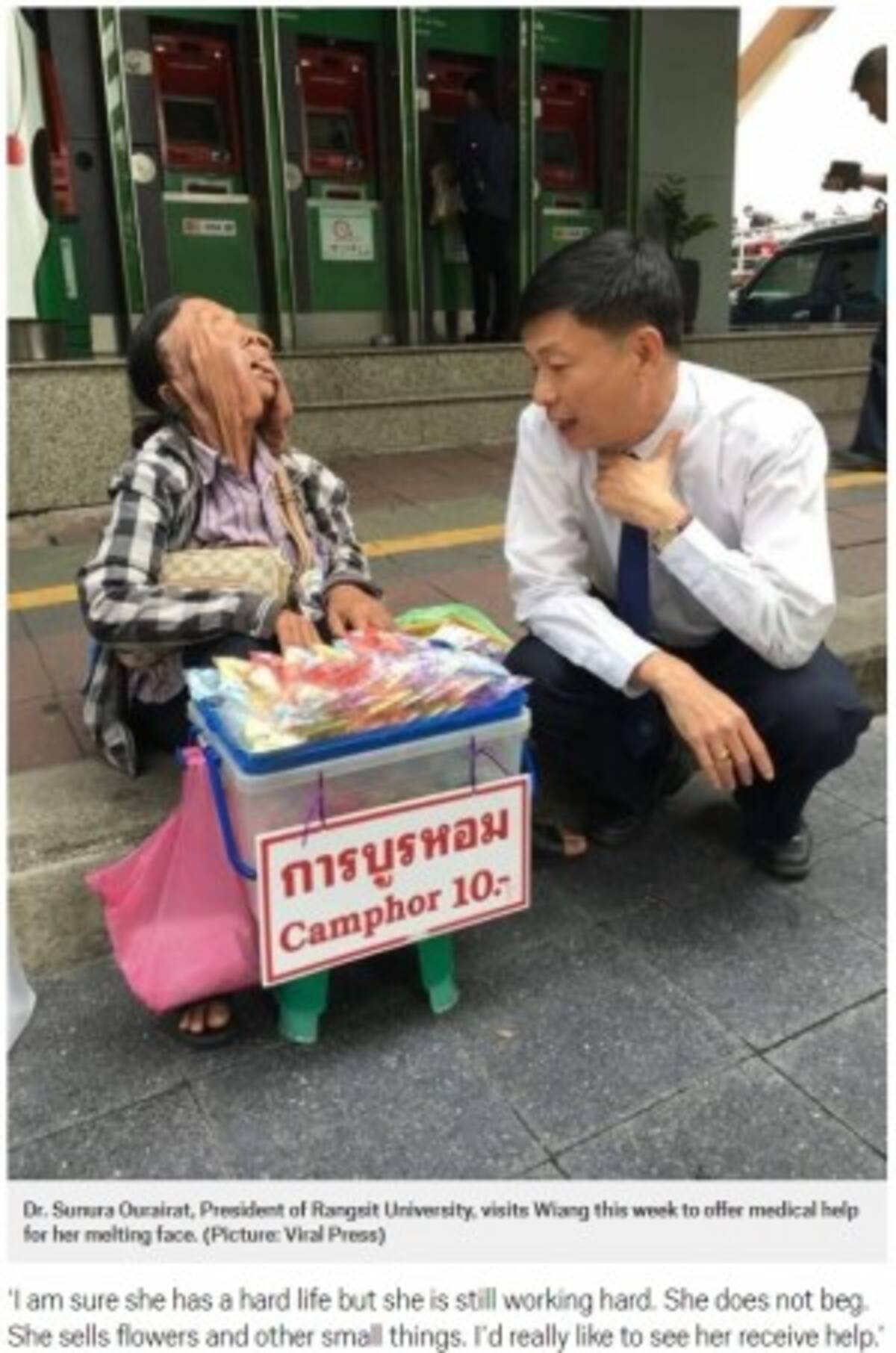顔の皮膚が垂れ下がり失明した63歳女性 手術を拒否 タイ 18年1月6日 エキサイトニュース
