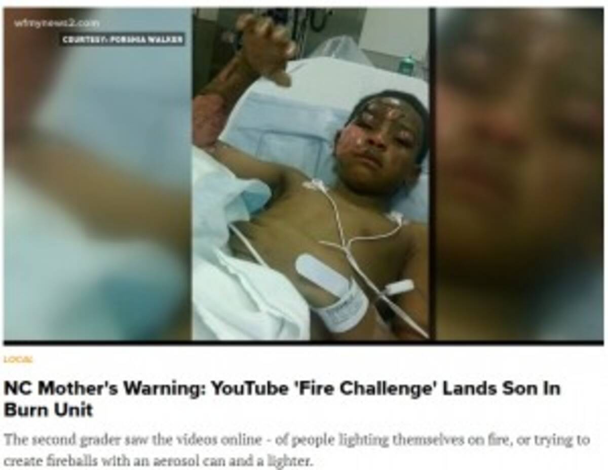 Youtubeで流行 ファイアー チャレンジ で7歳児が重傷 皆さんも気を付けて 涙の母親 米 2018年1月9日 エキサイトニュース