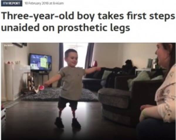 脚を切断した3歳児 義足をつけて初めて歩く 英 動画あり 18年2月25日 エキサイトニュース