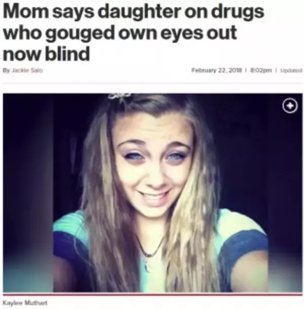 幻覚により自ら眼球をえぐり取った20歳女性　「薬物の怖さを知って！」と母（米）