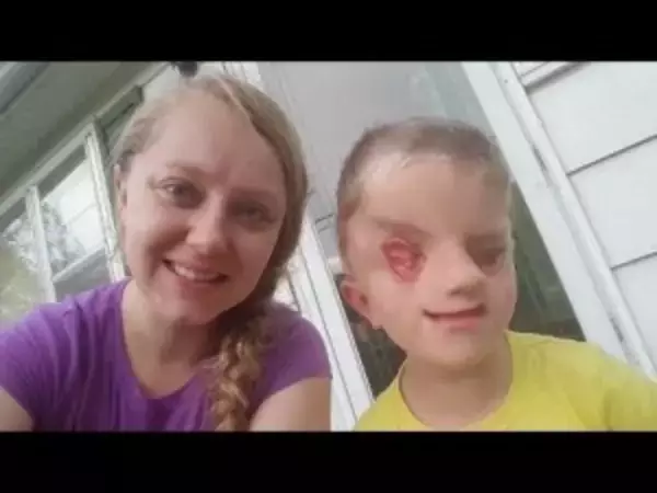 世界でわずか60例　全盲・顔面奇形で生まれた6歳男児の母親が世間に伝えたいこと（米）＜動画あり＞