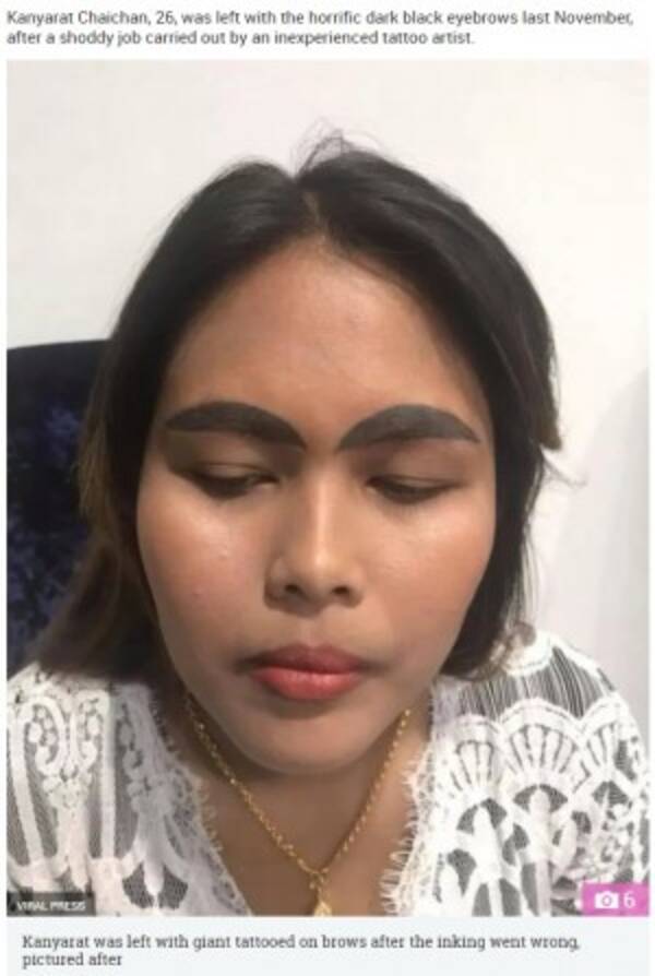 眉タトゥー失敗で“極太ナメクジ眉”になった女性（タイ）