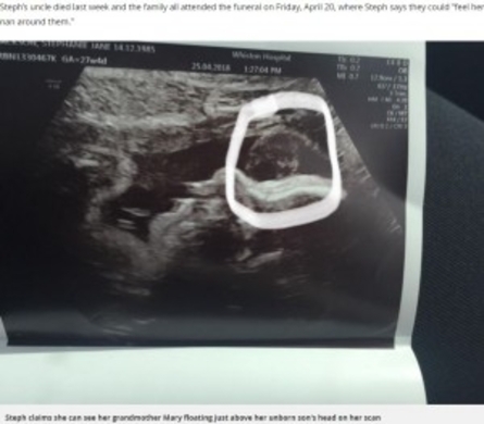 ゴリラ いやトランプ大統領 エコー写真に妊婦が愕然 英 21年1月16日 エキサイトニュース