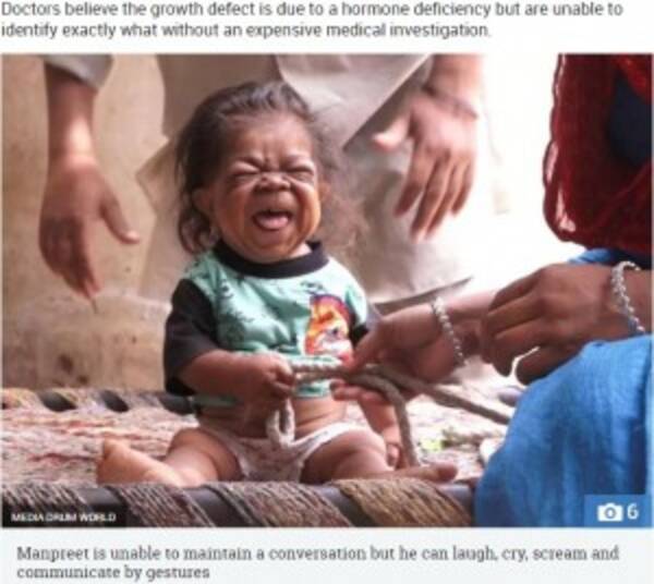 生後6か月のまま成長がストップ 心も体も幼児の23歳男性 印 18年5月6日 エキサイトニュース