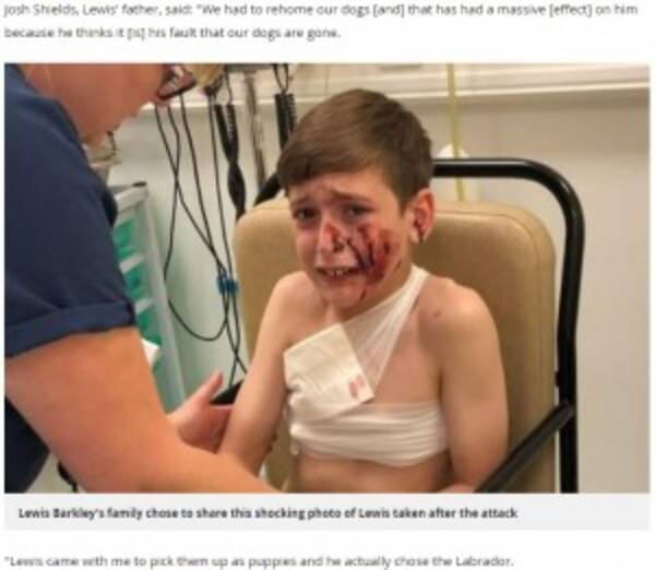 犬に襲われptsdを発症した男児の家族 苦渋の決断で飼い犬2匹を手放す 英 2018年9月25日 エキサイトニュース