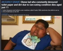 食べることが止まらない難病と闘う体重90kgの10歳少年 トイレットペーパーを食べたことも 南ア 17年7月29日 エキサイトニュース